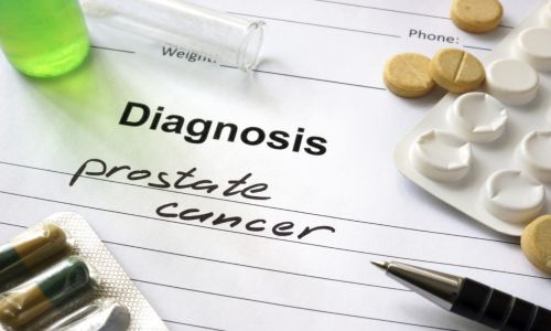راه های پیشگیری از سرطان پروستات